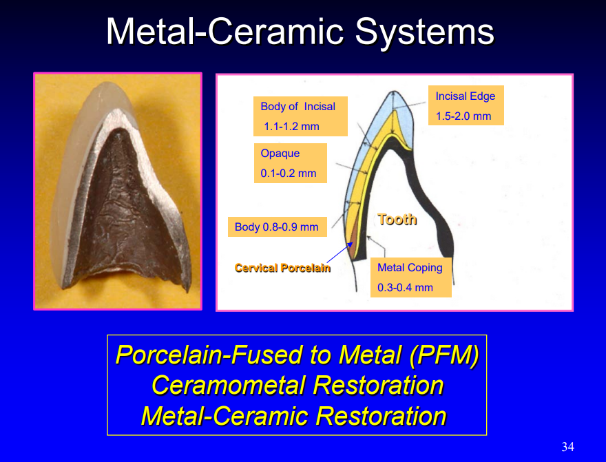 <ul><li><p>porcelain-fused to metal (PFM)</p></li><li><p>ceramometal restoration </p></li><li><p>metal-ceramic restoration </p></li></ul><p></p>
