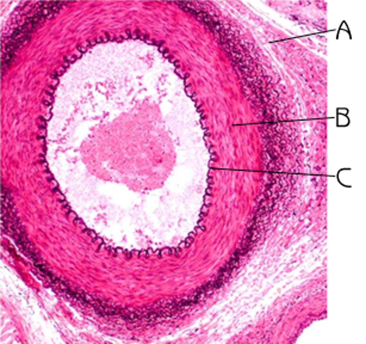 <p>Carries blood away from the heart</p>