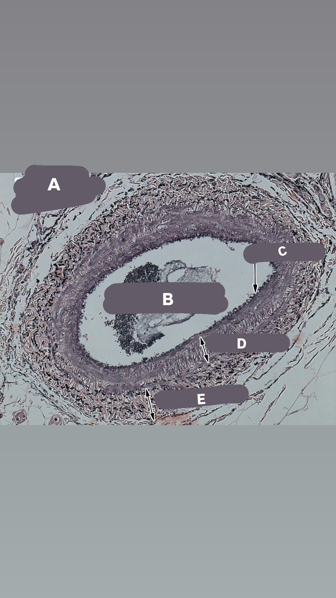 <p>what is c // no internal elastic membrane</p>