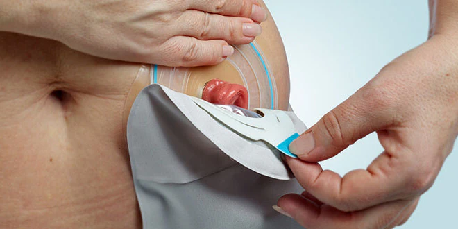 <p>above the groin,</p><p>right side of abdomen</p>