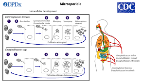 <ul><li><p>spore forming</p></li><li><p>15 species are pathogens to humans</p></li><li><p>distrubuted worldwide and have a wide host range</p></li><li><p>7-50% of aids patients infected</p></li><li><p>transmitted by inhalation of spores</p></li><li><p>unknown incubation period</p></li><li><p>Clinical syndromes:</p><ul><li><p>double infections with Cryptosporidium are common</p></li><li><p>symptoms: profuse, watery diarrhea</p><ul><li><p>dissemination to involve loss of vision, neurologic disturbances, hepatitis, UTI, pulmonary infections</p></li><li><p>clinical manifestations are very diverse, varying to causal species</p></li></ul></li></ul></li><li><p>Diagnosis:</p><ul><li><p>detection of organisms in biopsy and examination of cerebrospinal fluid and urine</p></li><li><p>molecular methods</p></li></ul></li><li><p>treatment and prevention:</p><ul><li><p>restoration of immune system</p></li><li><p>improved sanitation</p><p></p></li></ul></li></ul><p></p>