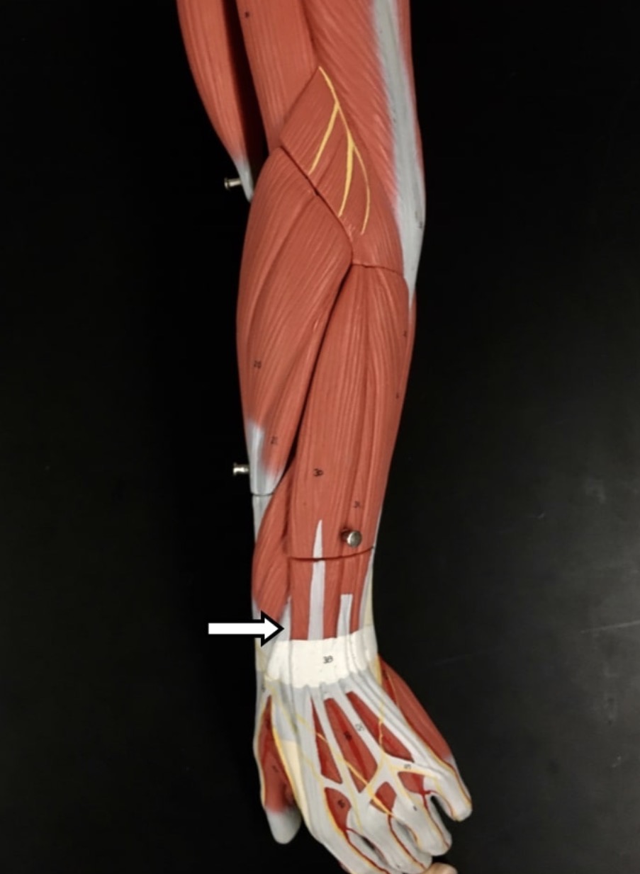 <p><span>Name the muscle that attaches to the tendon that is labeled with the white arrow</span></p>