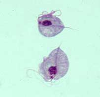 <p>Which type of disease does this parasite (Trichomonas vaginalis) cause?</p>