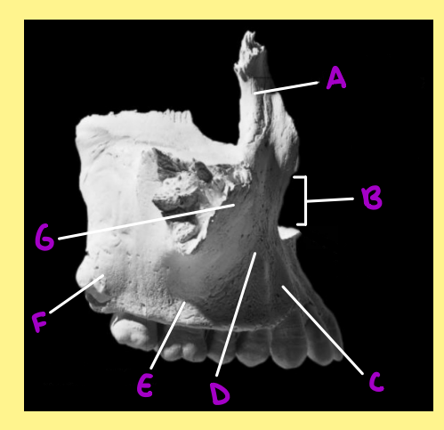 <p><u>Name the following</u>:</p><ul><li><p>Bone?</p></li><li><p>Side?</p></li><li><p>View?</p></li><li><p>B?</p></li></ul><p></p>