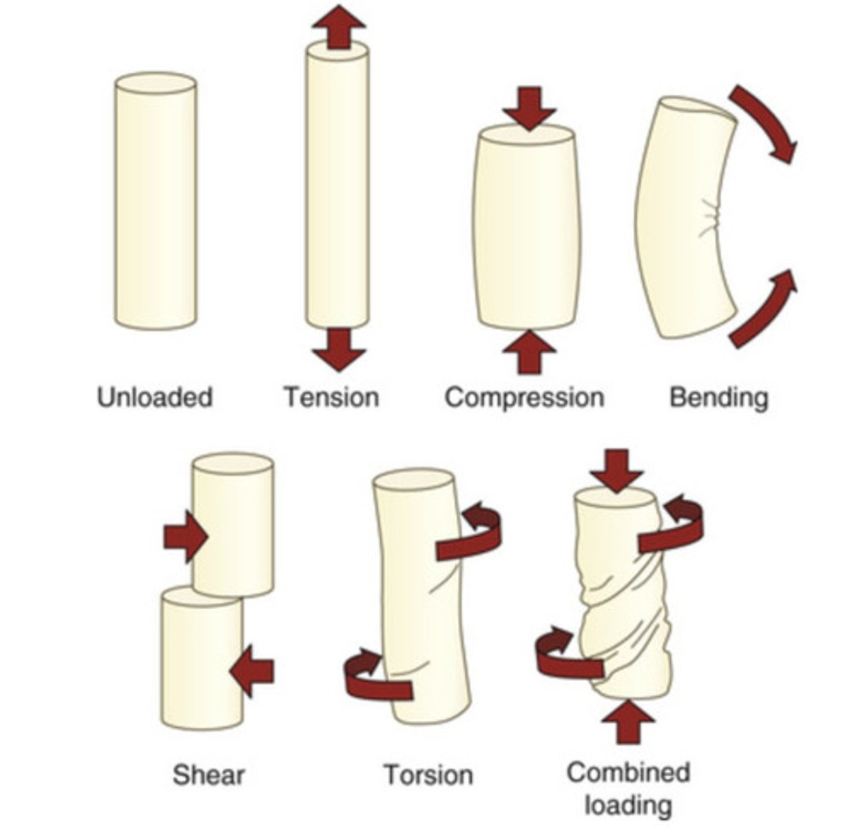 <p>Unloaded, tension, compression, bending, shear, torsion, combined loading (healthy tissues can withstand all!)</p>