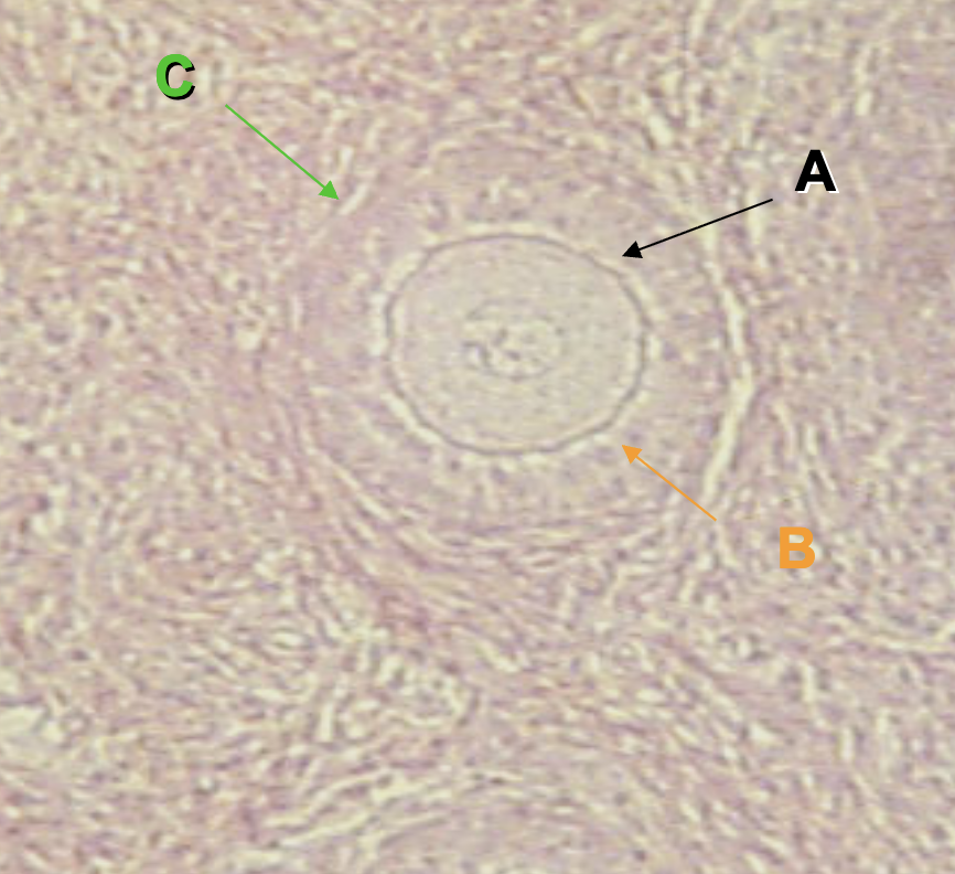 <p>What are the structures indicated by the letter A?</p><p>*Hint: </p>