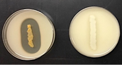 <ul><li><p><strong>Purpose</strong>: to detect the production of the enzyme casease</p></li><li><p><strong>Medium</strong>: Skim Milk Agar</p></li><li><p><strong>Type of Medium:</strong> differential</p></li><li><p><strong>+ results</strong> = clear zone around growth</p></li><li><p><strong>- results</strong> = no clear zone</p></li><li><p><strong>significant specific ingredients:</strong></p></li><li><p><strong>reagents/indicators:</strong></p></li><li><p><strong>specific directions</strong> (if any): streak agar in a straight line and incubate</p></li><li><p><strong>significant results:</strong></p></li></ul>