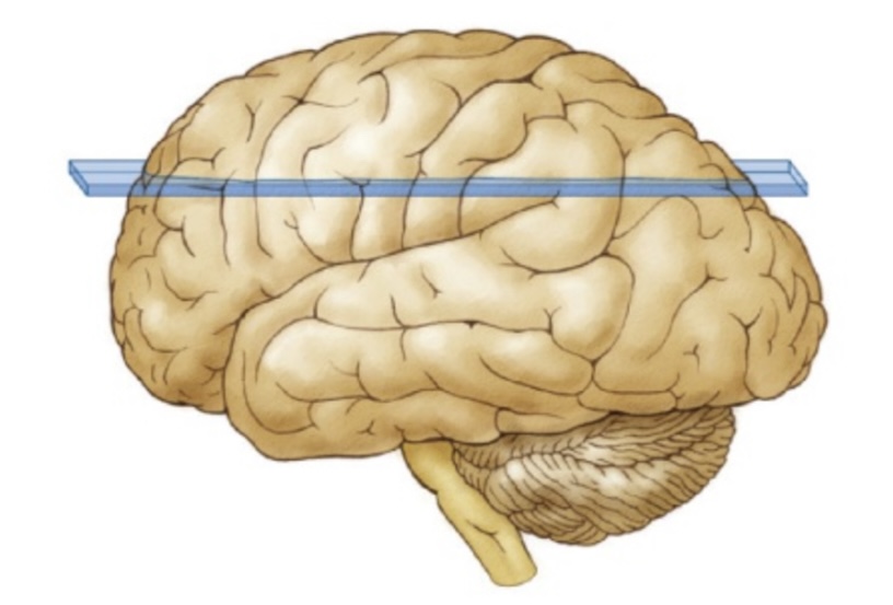 <p>The section cut along the horizon, which produces a dorsal view of the brain.</p>