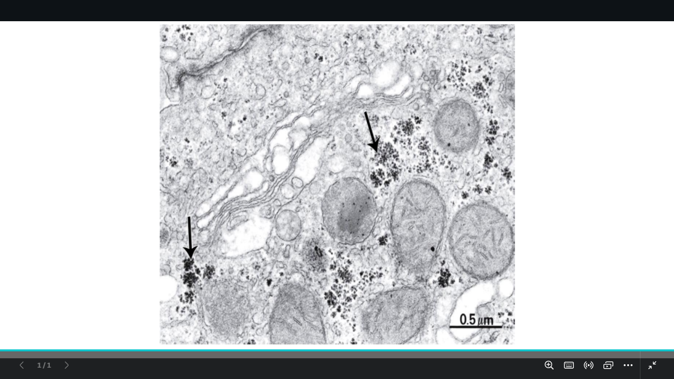 <p>identify</p><p>mention the type</p><p>name the organ</p>