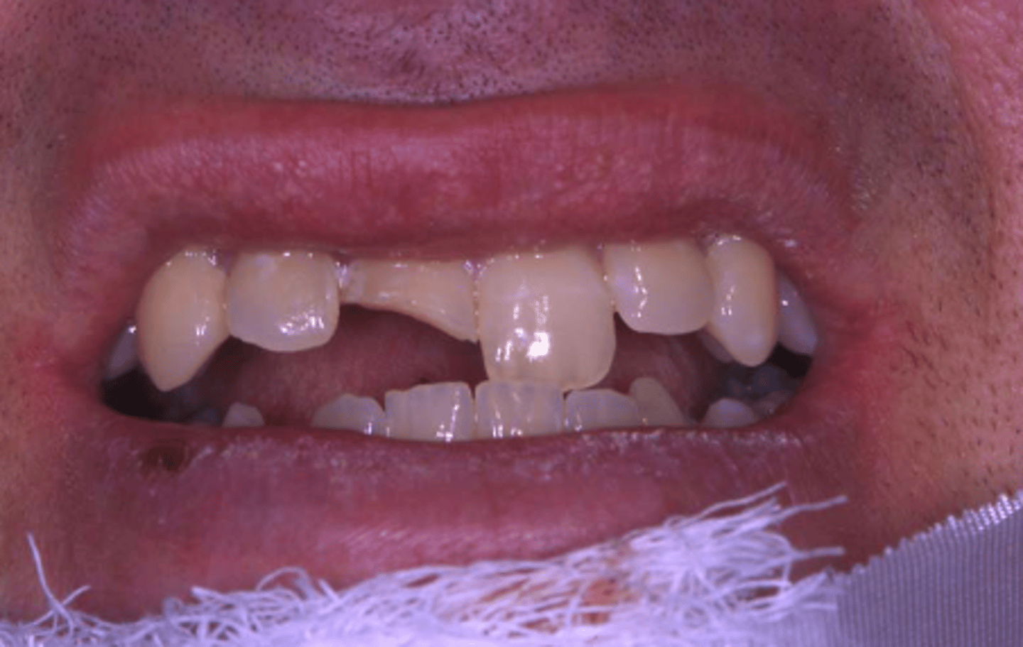<p>What caused this defect?</p>