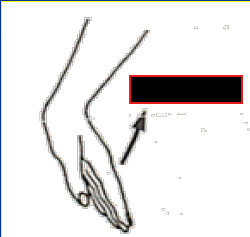 <p>What Movement is occurring?</p>