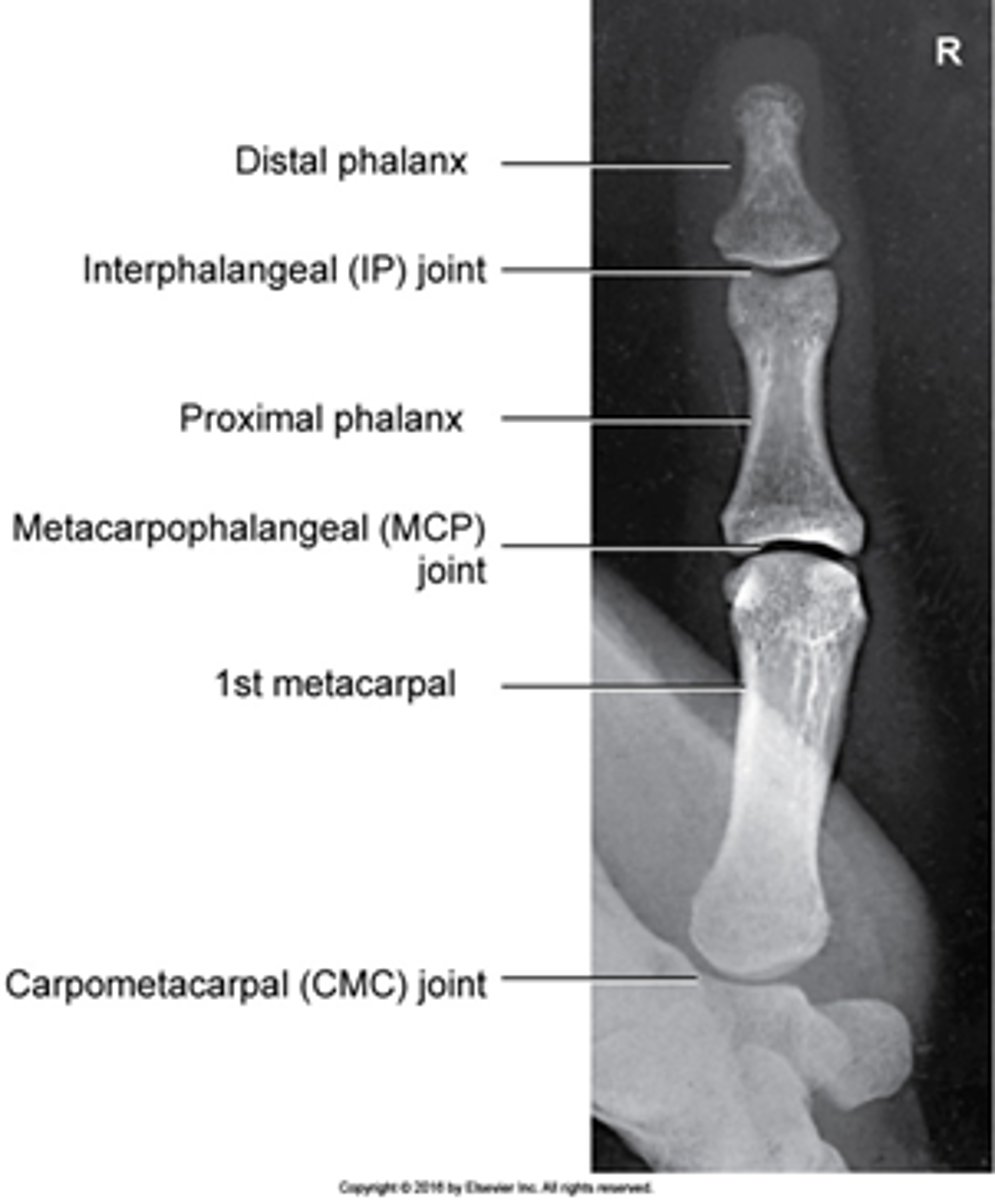 <p>-Entire thumb demonstrated (including first CMC joint)</p><p>-CR at first MCP joint</p><p>-No rotation</p><p>-concavity of phalangeal and metacarpal bodies</p><p>-Open IP and MCP joints</p>