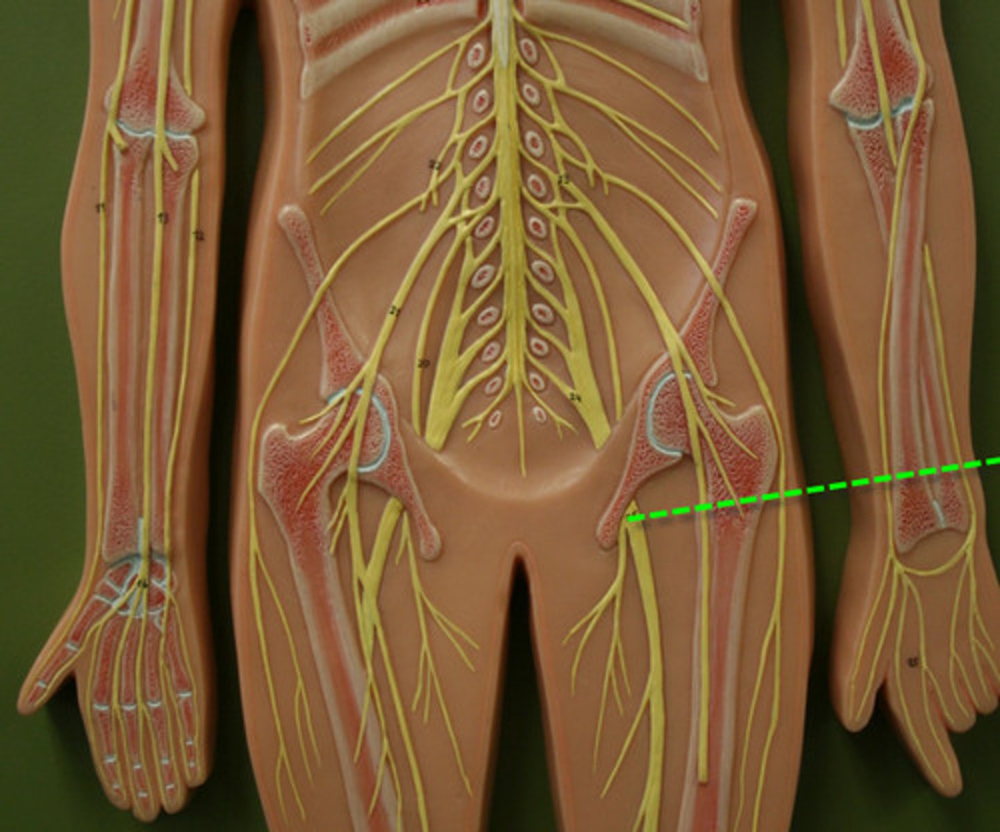 <p>nerve extending from the base of the spine down the thigh, lower leg, and foot; largest nerve in the body</p>
