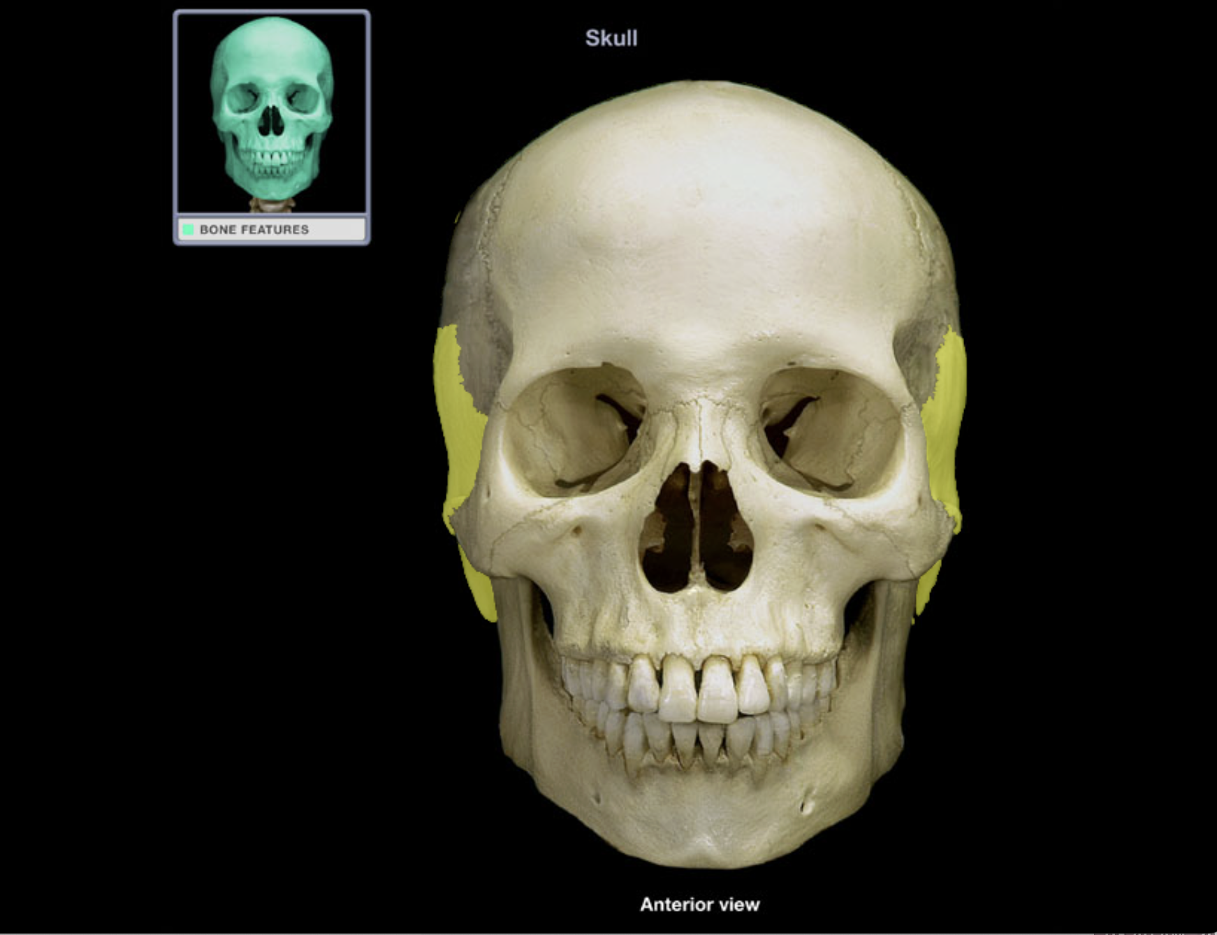 <p>Temporal bone</p>