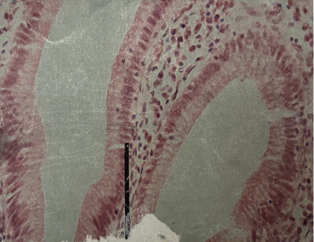 <p>What kind of tissue/cartilage is this? </p>