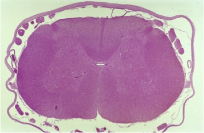 <p>The <strong>central canal</strong></p><ul><li><p>Lined with EPENDYMAL cells and FILLED WITH CSF&nbsp;</p></li></ul><p></p>