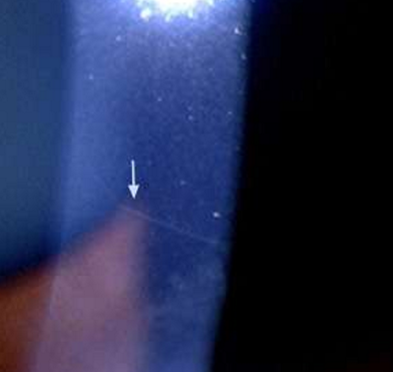 <p>What condition is this?</p>