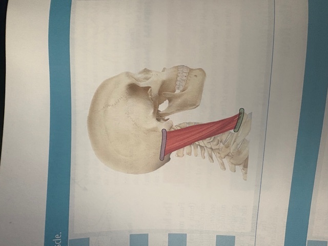 <p>Sternocleidomastoid </p>