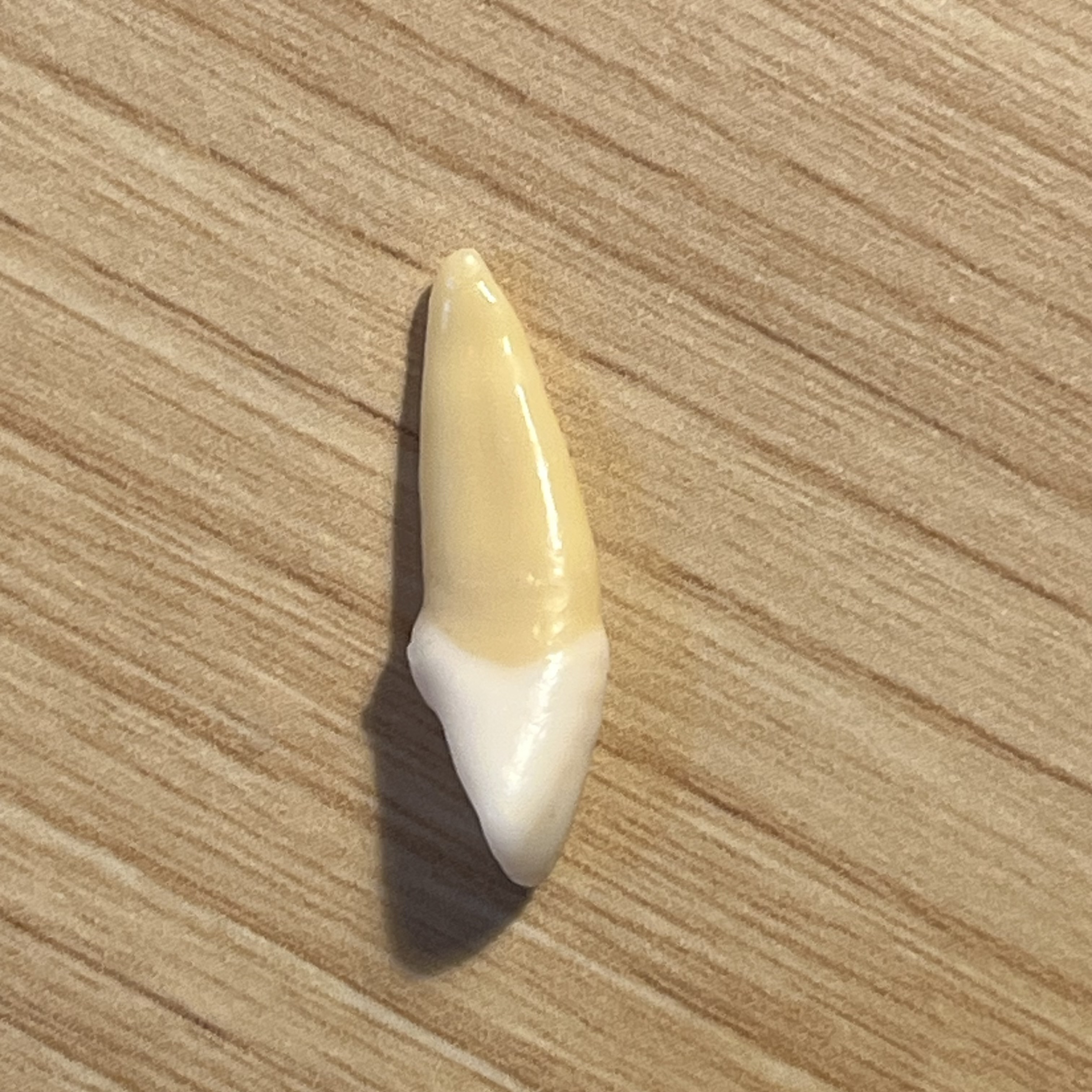 <p>What tooth is this (with view)?</p>