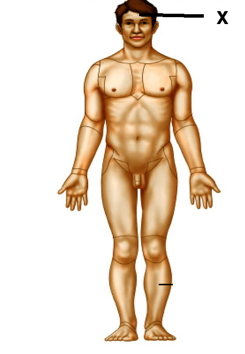 <p>Identify the body area</p>
