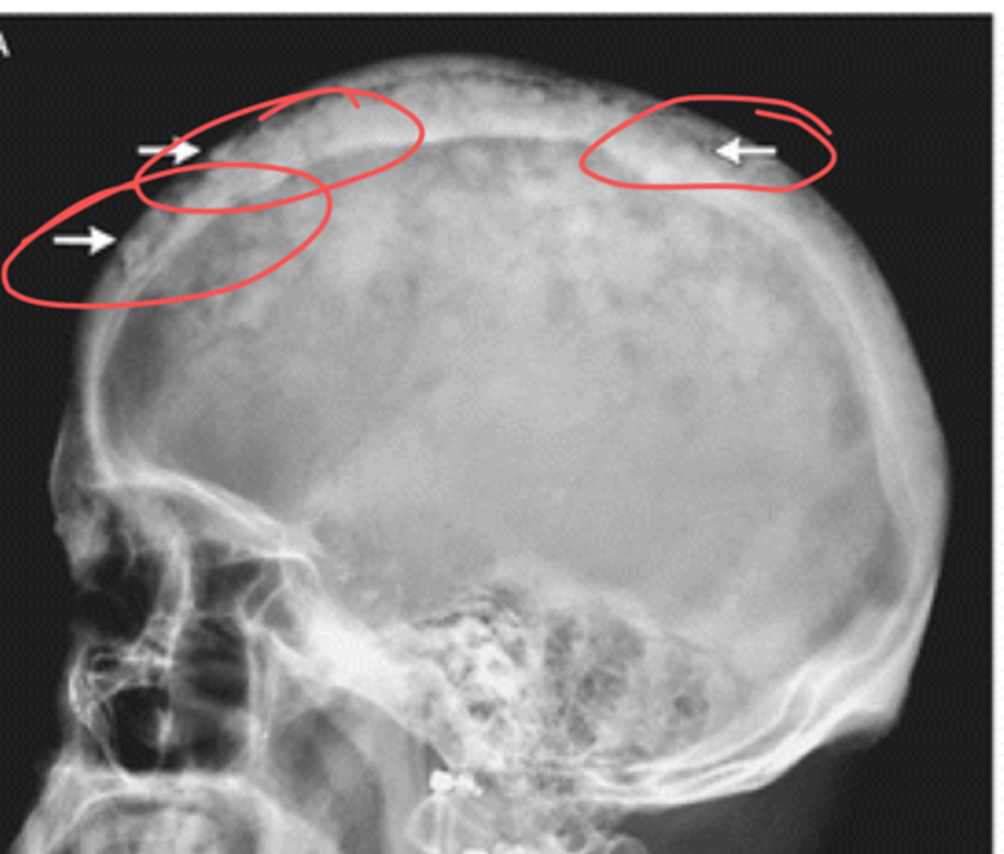 <p>what is this and what causes it</p>