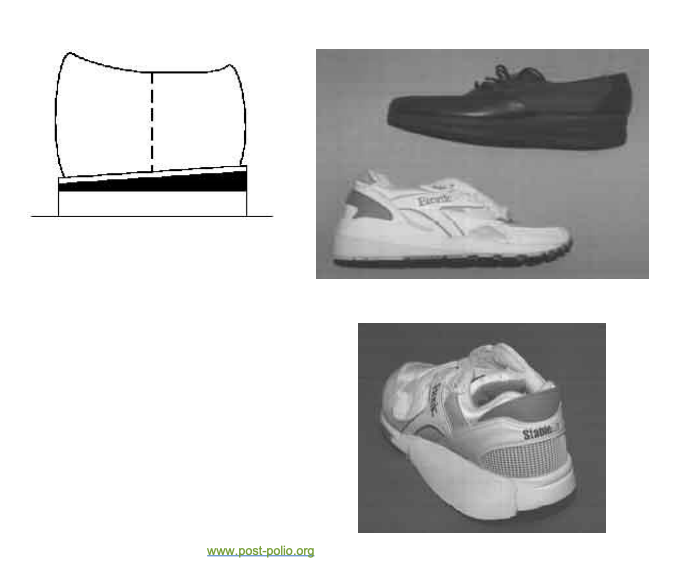 <p><span data-name="black_small_square" data-type="emoji">▪</span> Heel modifications</p><ul><li><p>Heel cushion</p></li><li><p>Heel wedge</p></li><li><p>Heel elevation</p></li></ul><p><span data-name="black_small_square" data-type="emoji">▪</span> Sole modifications </p><ul><li><p> Sole wedge</p></li></ul><p></p>