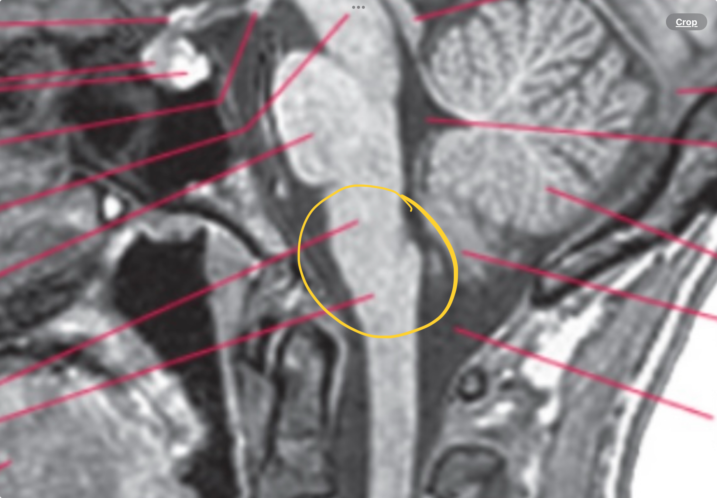 <p>Medulla</p>