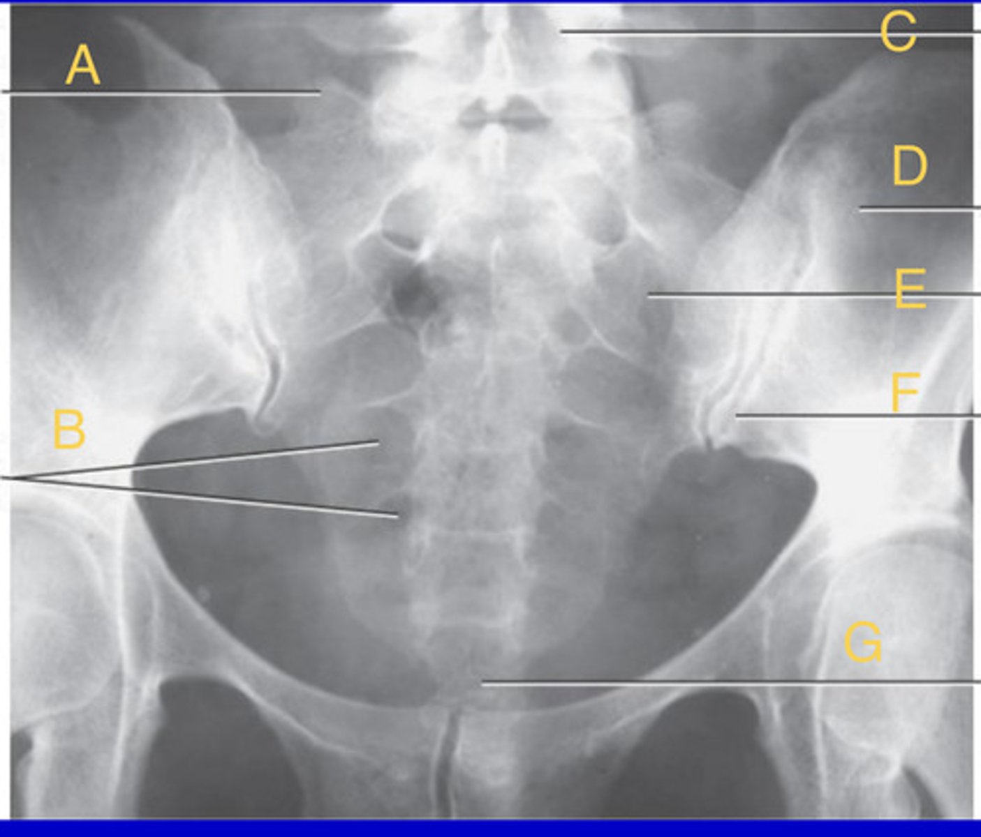 <p>What position?</p>