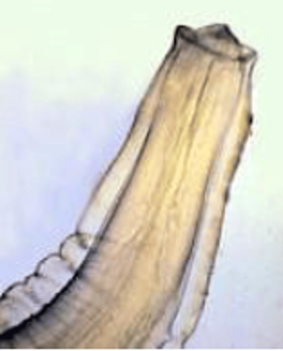 <p>Physaloptera sp.</p>