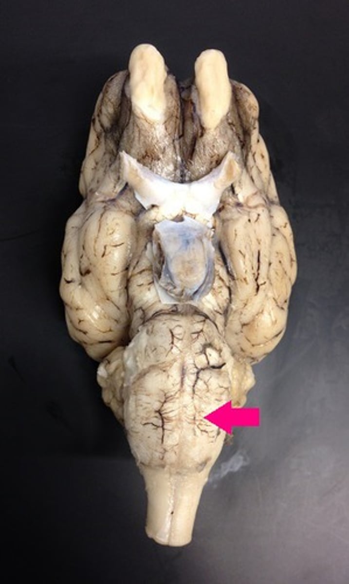 <p>Identify the structure.</p>