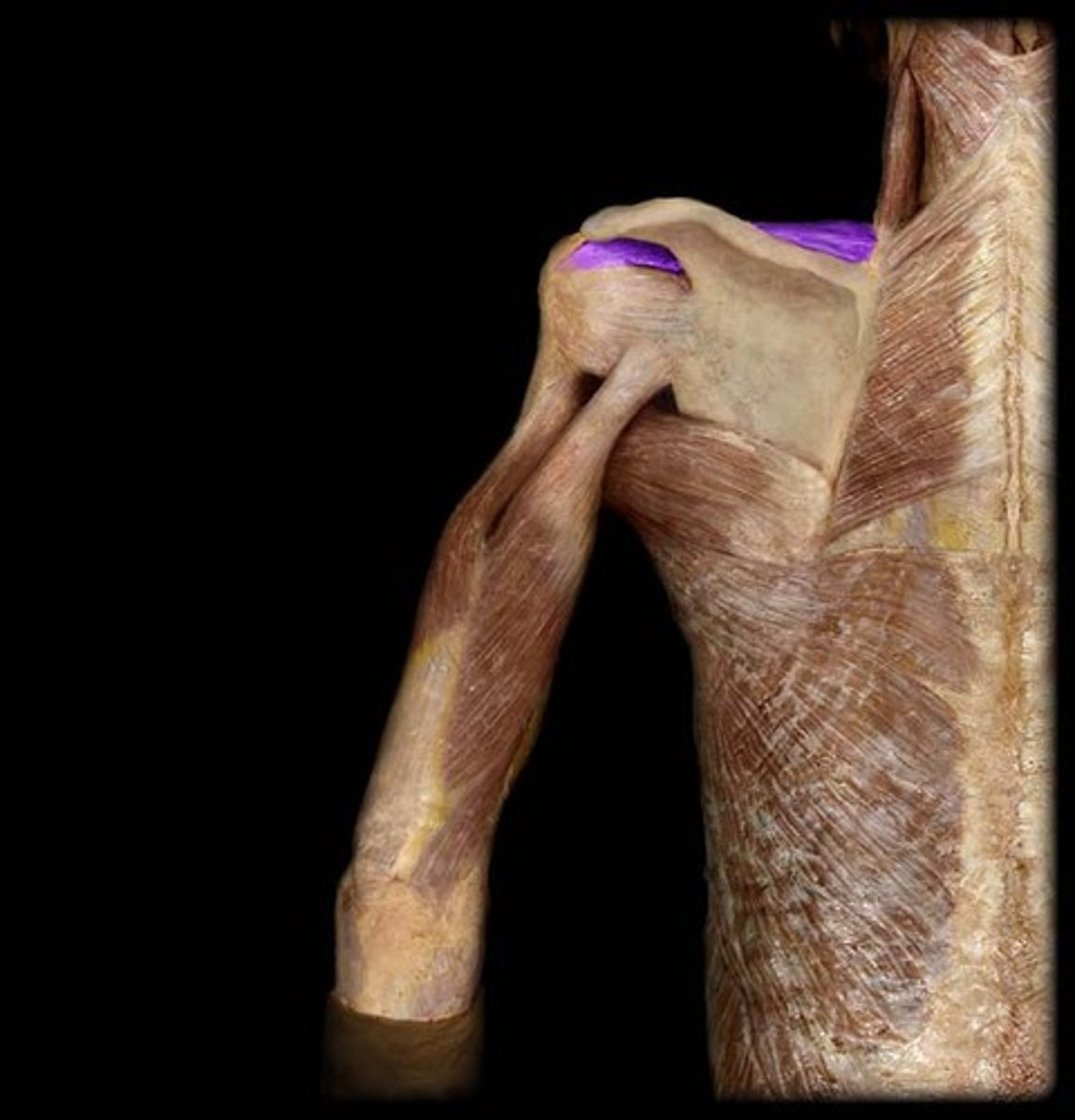 <p>What is this muscle, and what is its action, Proximal &amp; Distal insertions?</p>