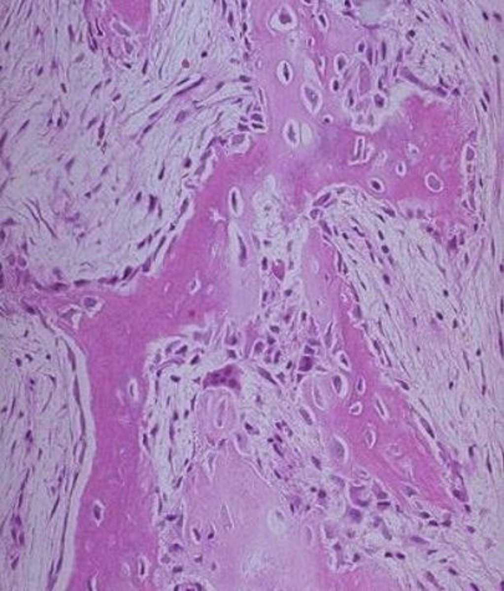 <p>- Första bentyp som bildas och kännetecknas av snabb benbildning</p><p>- Kollagenfibrerna slumpmässigt arrangerade</p><p>- Låg mineralhalt</p>