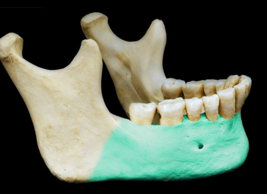 <p>Body of mandible</p>