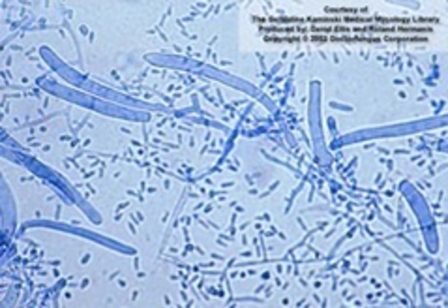 <p>Colony: powdery-downy, granular, white-pink</p><p>Reverse: red or yellow-brown</p><p>Microconidia: claviform or pyriform "birds on a wire"</p><p>Macroconidia: cigar shaped, often absent; septate and may be at end of hyphae</p><p>septate hyphae</p><p>Conditions: skin and nails common</p><p>Rare: beard/hair/scalp</p>