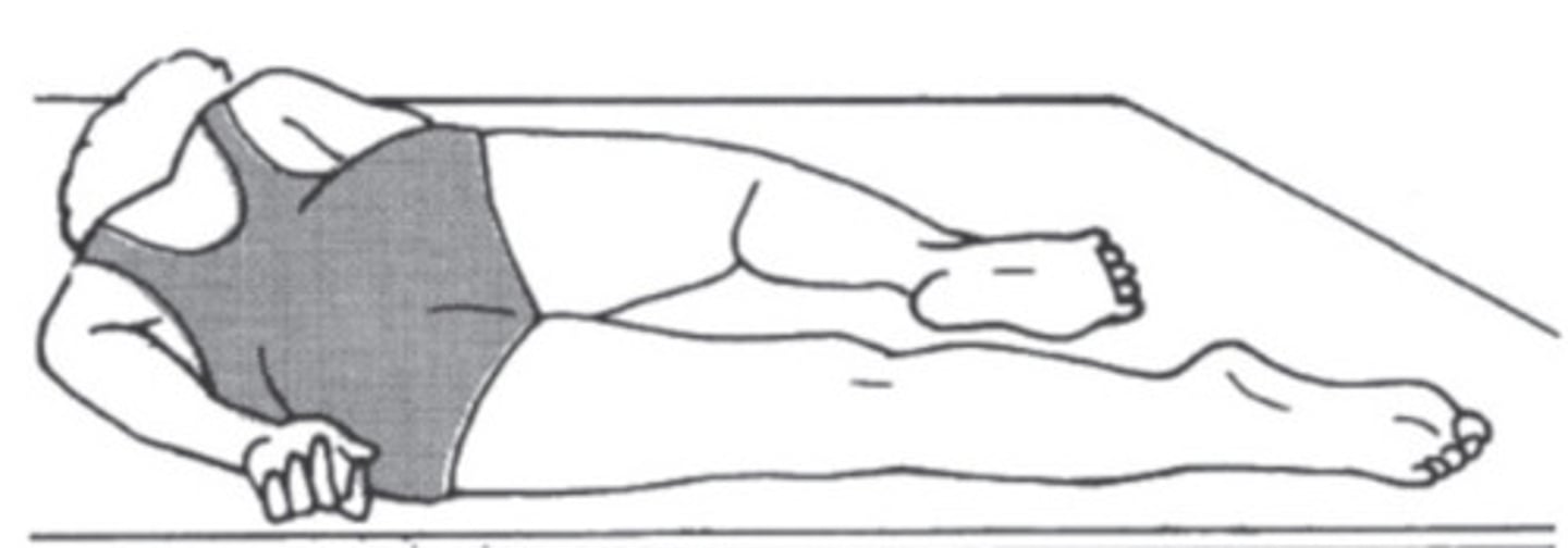 <p>lying on side in a semi-prone position with the knee drawn up toward the chest and the arm drawn behind parallel to the back</p>