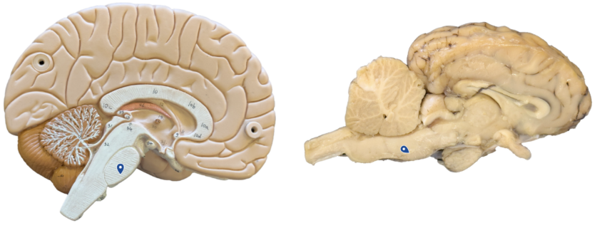 <p>What structure is the arrow pointing to?</p>