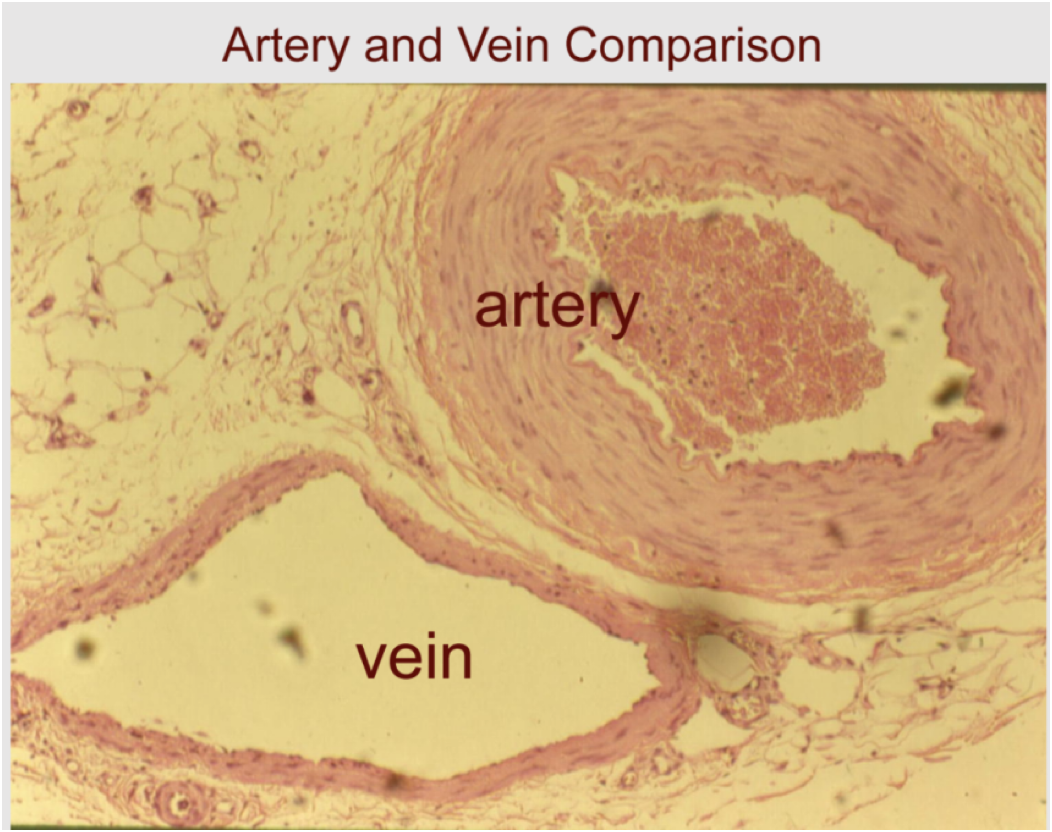 <p><strong>veins</strong>: less elastic</p><p>-steady blood flow</p><p>-relatively ___ (high/ low?) blood pressure</p>
