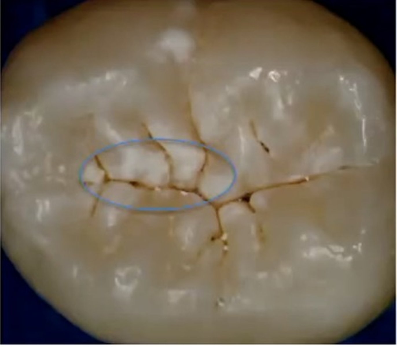 <p>identify the lesion</p>