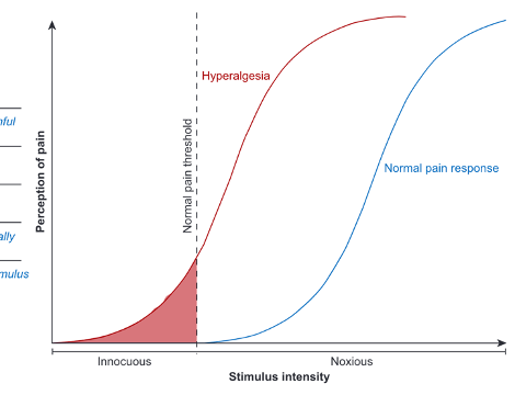 <p>increased pain from a stimulus that normally provokes pain</p><p></p><p></p>