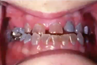 <p>what is the condition? </p>