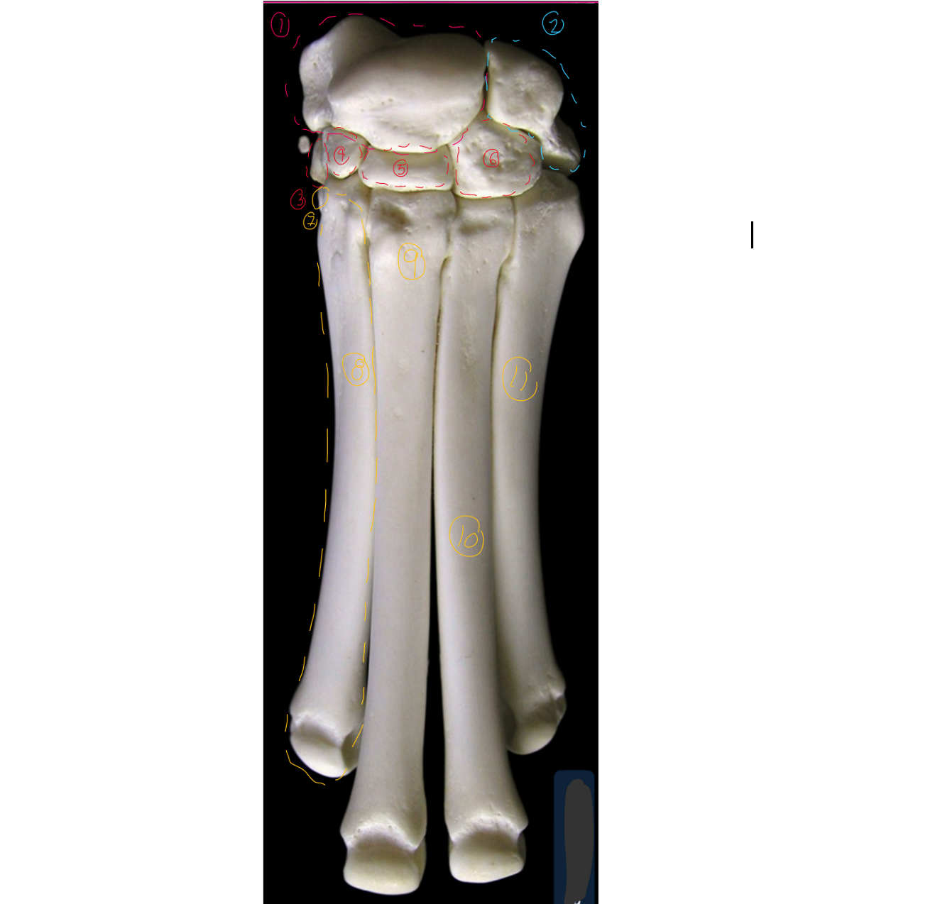 <p>label the cranial view of the carpus/metacarpus (this is like looking right in front of the dog, medial to left, lateral to right)</p><p></p><p>7-11 → SPELLING</p>