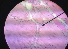 <p>Location: Glands, ovaries, and kidneys</p><p>Function: Secretion and absorbs</p>