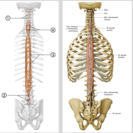 <p><span><span>Origo en insertie:<br></span></span><span data-name="black_small_square" data-type="emoji">▪</span><span><span> Cervicis: tussen de proc. Spin.<br>van C I – VII<br></span></span><span data-name="black_small_square" data-type="emoji">▪</span><span><span> Thoracis: tussen de proc. Spin.<br>van Th I-XII<br></span></span><span data-name="black_small_square" data-type="emoji">▪</span><span><span> Lumborum: tussen de proc. spin.<br>Van L I-V</span></span></p><p><span><span><br></span></span><span data-name="black_small_square" data-type="emoji">▪</span><span><span> Functie:<br></span></span><span data-name="black_small_square" data-type="emoji">▪</span><span><span> extensie LWK en CWK</span></span></p><p><span><span><br></span></span><span data-name="black_small_square" data-type="emoji">▪</span><span><span> Innervatie:<br></span></span><span data-name="black_small_square" data-type="emoji">▪</span><span><span> rr. Dorsales van spinale zenuwen</span></span></p><p><br></p>
