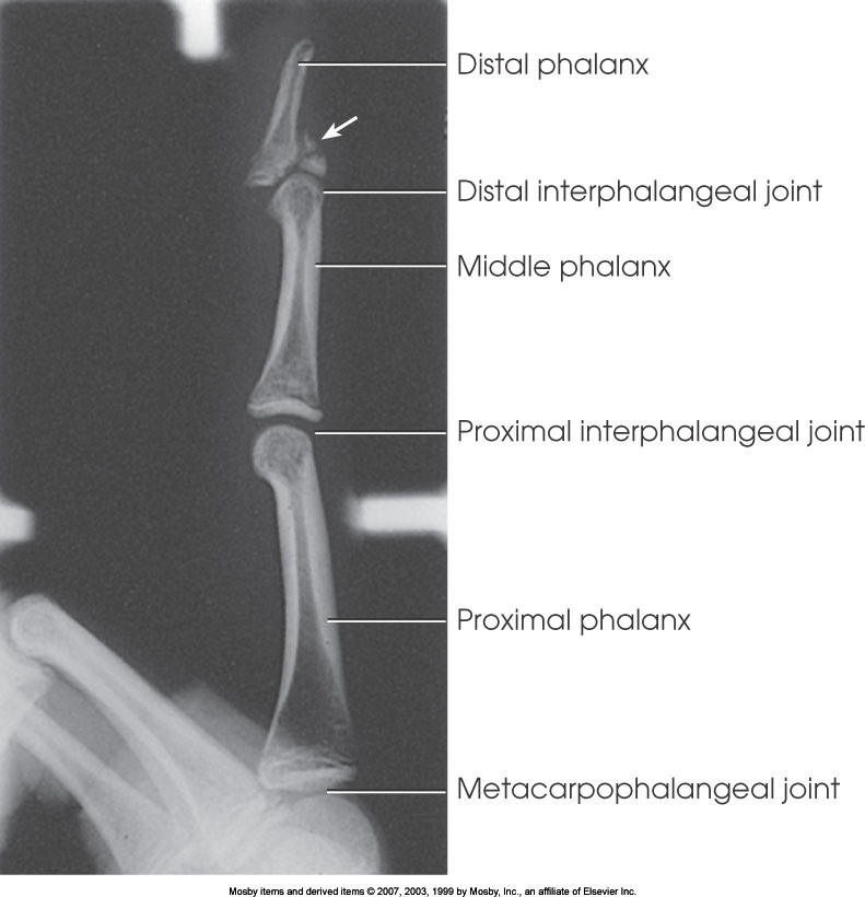 <p>What position is demonstrated?</p>