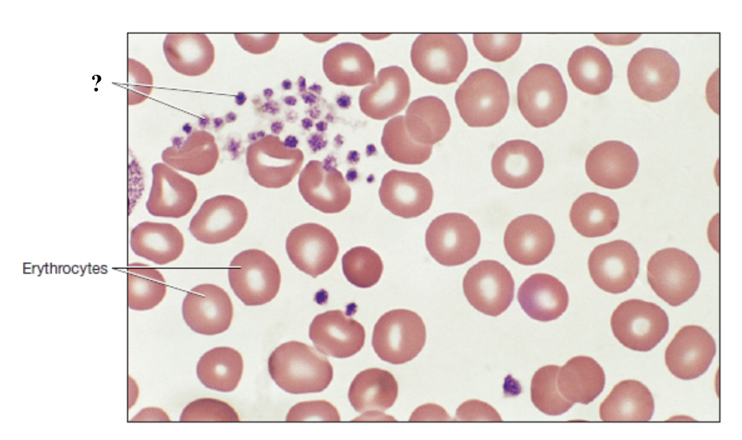 <p>platelets that function in hemostasis by forming platelet plugs and the initiating blood clotting process</p><ul><li><p>make up less than 1% of total blood volume</p></li><li><p>not true cells, lack nucleus and most organelles</p></li><li><p>circulate for 5 to 6 days before removed by spleen or liver</p></li></ul><p></p>