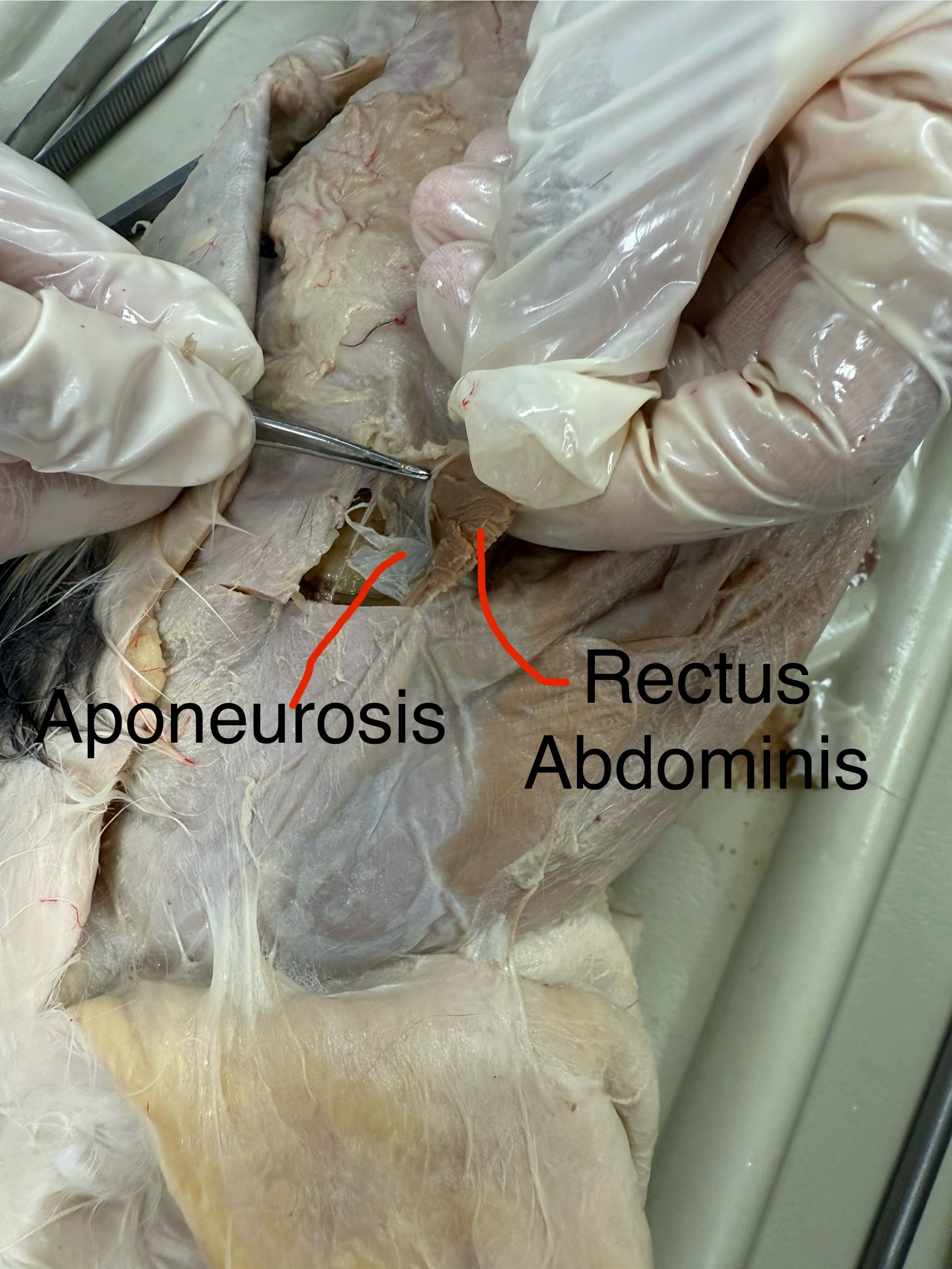 <p>Rectus abdominis action: compresses abdomen </p>
