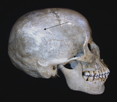 name the bone 