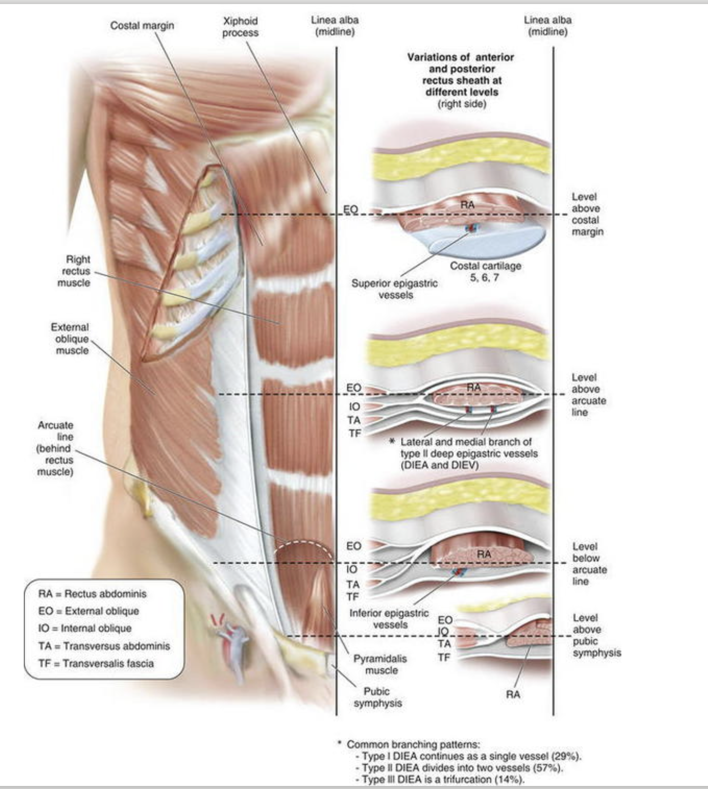 <p>The rectus sheath </p>