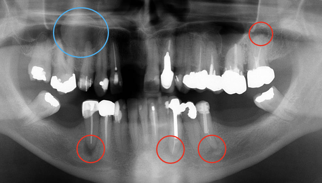 <p>what do the red and blue circles indicate</p>