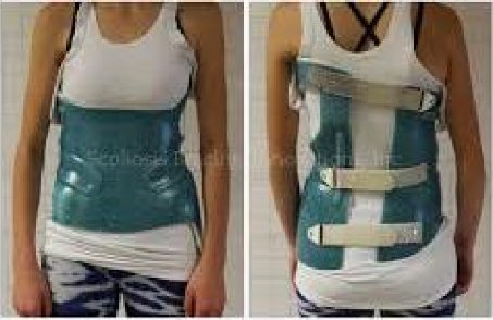<p>Name this brace. How is it constructed?</p>